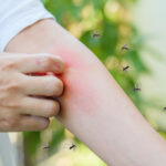 2025-1114-malaria-01